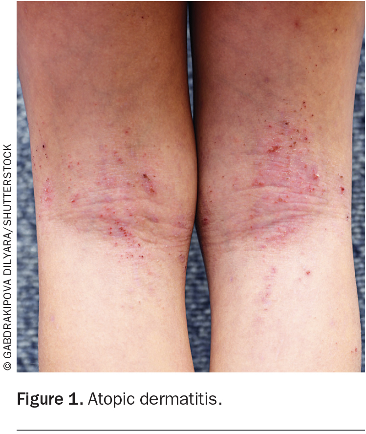 Common and important skin rashes in primary care Medicine Today